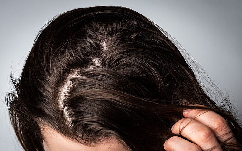 A close-up of a person with dark hair bowing their head, one hand running through limp, oily-looking roots against a grey background. Featured image for blog post: Why You Have Greasy Hair and How To Fix It
