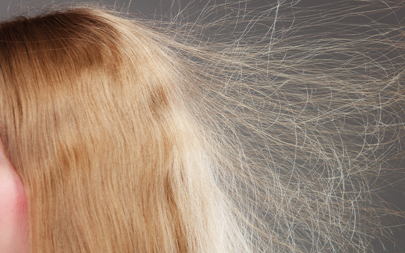 An extreme close-up of the crown of a person's head showing fine, light blonde hair with significant static fly-aways lifting and separating from the scalp. Featured image for blog post: How To Get Static Out of Hair With These Quick Fixes