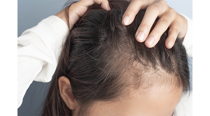 Don’t Wig Out Just Yet—Here’s a Guide to Thinning Hair Solutions